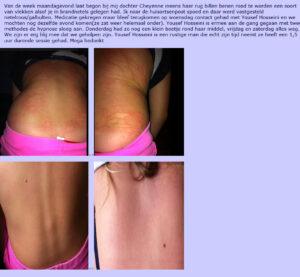 Stoppen met roken in Breda hypnohelp